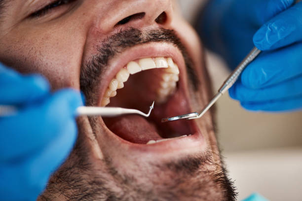 Best Urgent Tooth Repair  in Holly, MI
