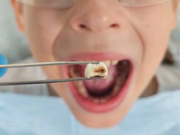 Best Knocked-Out Tooth Emergency  in Holly, MI