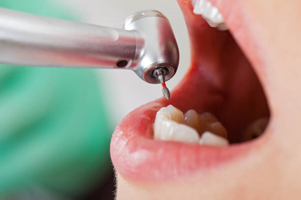 Best Root Canal Emergency Dentist  in Holly, MI